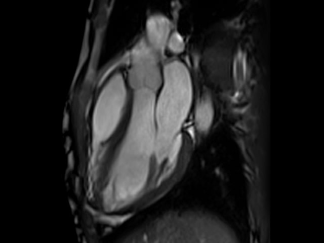 Cardiac CT Scan