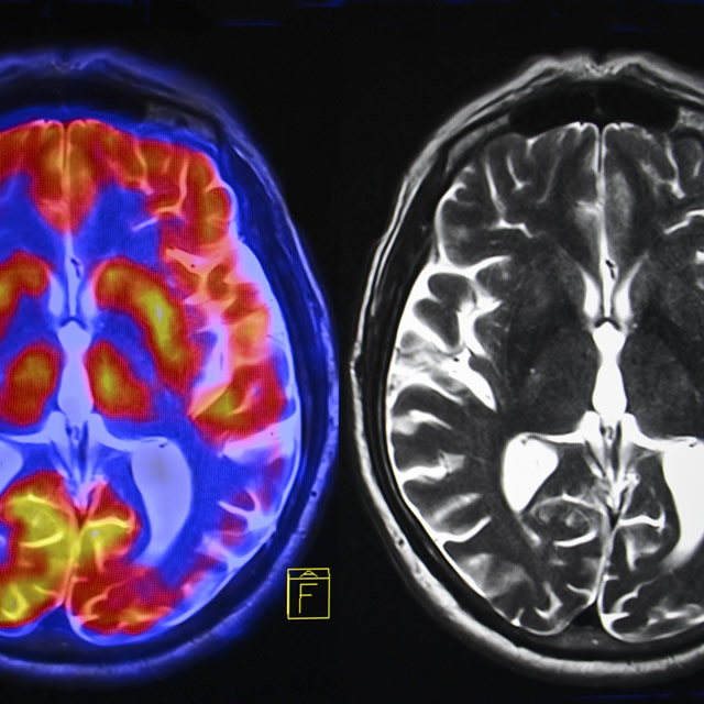 Neuro Imaging