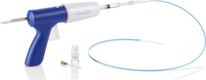 VenaSeal Varicose Vein procedure